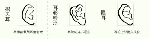 上海做耳畸形再造手术费用价格整理，2025年部分价格明细有调整哦！