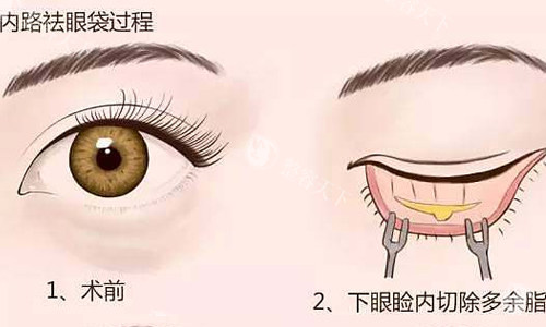 郑州董琪医生怎么样​？无论是面对想要隆鼻、双眼皮手术，还是吸脂塑形的求美者，他都会认真倾听