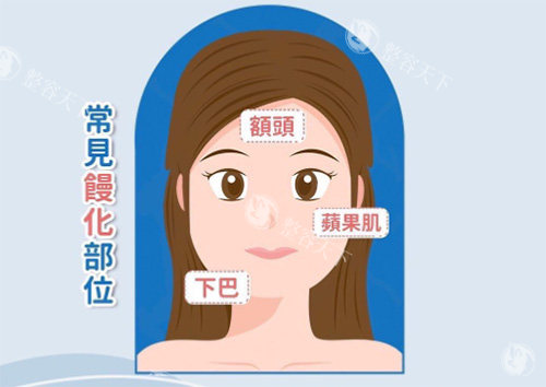 上海王洪馒化脸修复怎么样？蜂巢式抽取解决填充过度，收费透明超放心！