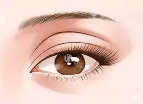 孔宇修复双眼皮做得好吗​？为患者打造出自然、美观的双眼皮