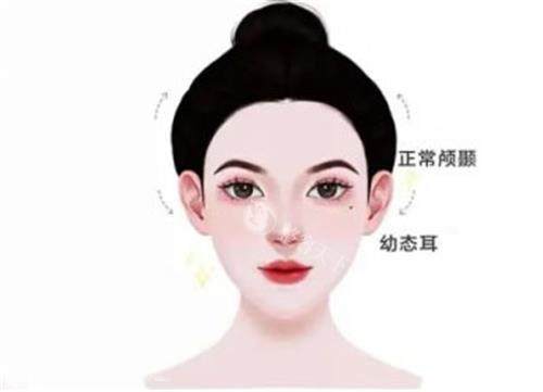 成都幼态脸加轮廓固定多少钱？玻尿酸填充3000元起/自体脂肪填充1万元起/胶原蛋白5000元起~