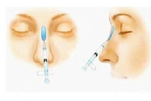 上海打尿酸注射价格表2025，润百颜1280元起、伊婉C1880元起、艾莉薇2500元起、乔雅登5000元起