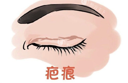 成都双眼皮修复出名的医生汇总：林靖、卢尚兵、蔡灵、肖凌、杨迪、徐敦这些医生技术真好！