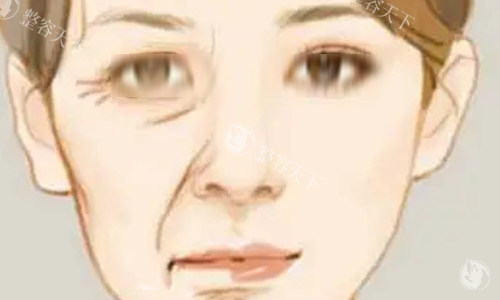 深入对比：谢洋春和陈兵拉皮谁技术好？为你挑选优质拉皮医师！