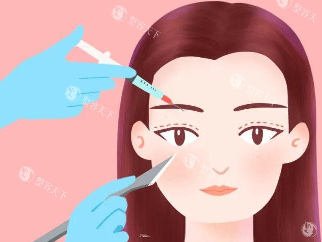 济宁李春燕怎么样？双眼皮修复与鼻部整形医师，十余年经验打造自然精致美，求美者零差评