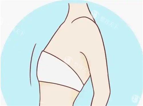 深圳脂肪填充胸哪个医生好？郭杰、唐新辉、刘月更、牛克辉、李子鹏5位隆胸技术出了名的好