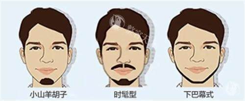 广州出名的种植胡子医院是哪家?倍生/曙光/青逸/熙朵做胡须种植技术口碑都不错!
