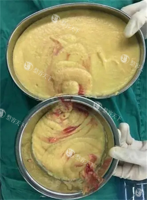 广州漫一凡在哪家医院?坐诊地点发布:荔湾区人民医院整形科预约全攻略