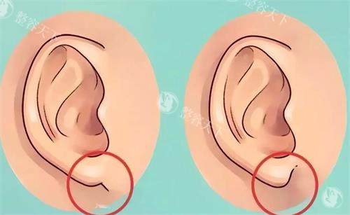 章庆国医生做耳畸形修复怎么样​？丰富的经验、个性化的方案制定、娴熟的手术技术