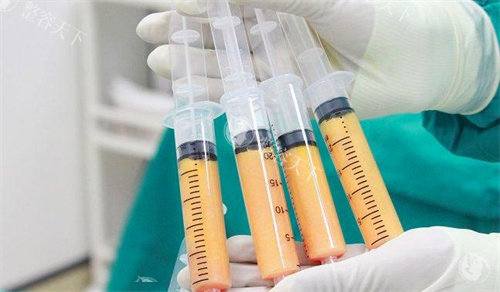 武汉彭义坤和王彬哪个医生做自体脂肪丰胸更好？自体脂肪存活率/价格/口碑综合挑选攻略