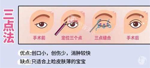 北京加减美医疗美容凭什么出圈？优势对比：技术创新性vs项目个性化vs术后管理