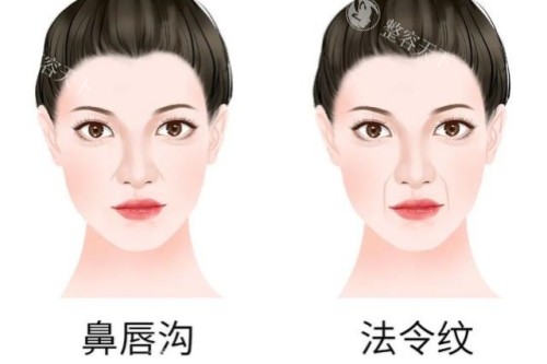 龙鹏辉隆鼻口碑好吗​？采用双C耳软隆鼻，术后鼻子自然稳固、耐看
