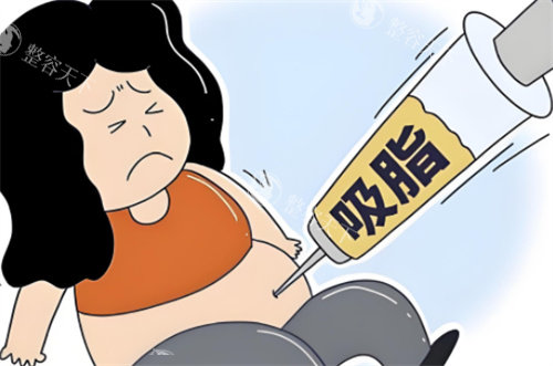 俞积贵医生做抽脂怎么样？简介、技术优势、真实口碑、价格等您看下