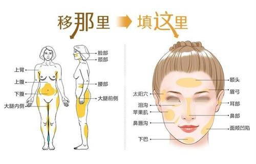 武汉彭义坤和王彬哪个医生做自体脂肪丰胸更好？自体脂肪存活率/价格/口碑综合挑选攻略