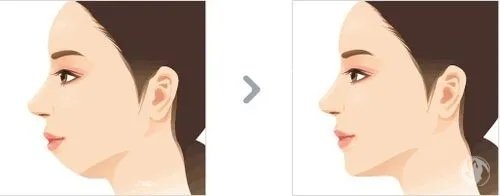 重庆朱乐林医生口碑怎样，做面部轮廓手术特别好经验很充足！