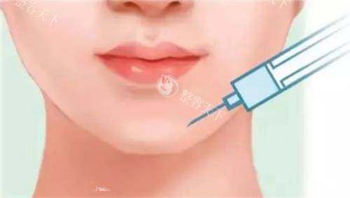 莉莉公主玻尿酸多少钱一支？基础系列4500元起、中端系列8000元起