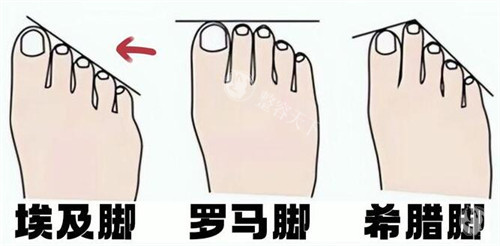 二脚趾缩短手术风险高吗？这4种情况千万要当心！