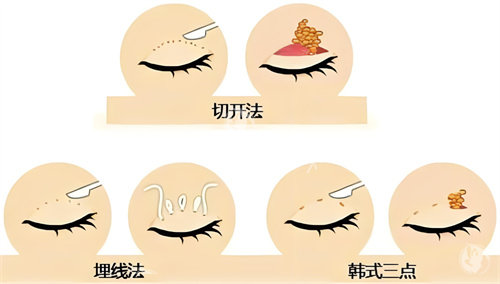 曹智慧医生做眼睛怎么样​？丰富的临床经验、个性化的方案设计、娴熟的手术技术