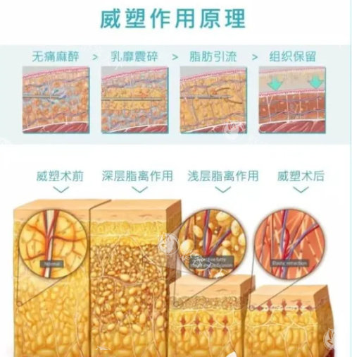 西京医院磨骨/吸脂价目更新！附医师预约避坑技巧！