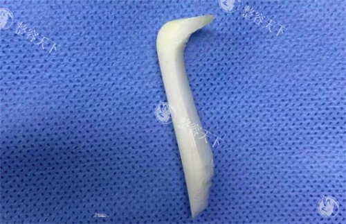成都铜雀台周柯做初鼻现在多少钱？初鼻整形1万元起步的价格！