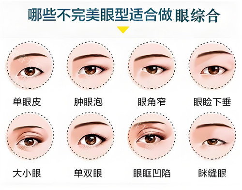 合肥徐和林眼综合做的好吗？高满意度实例分享，自然灵动双眼皮技术大揭秘