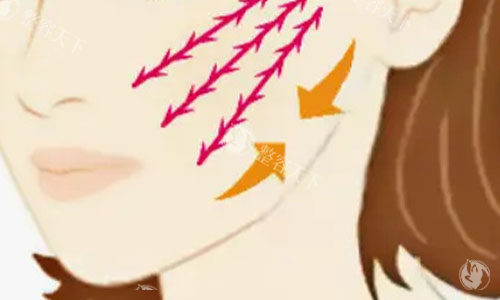 郑州宋连成做拉皮咋样？将从医生拉皮口碑、技术特点、网友真实评价来介绍，是一位靠谱的医生~
