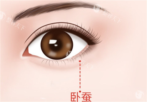 郑州贺焕焕修复卧蚕咋样​？凭借个性化方案和精细技术，收获了较好的评价