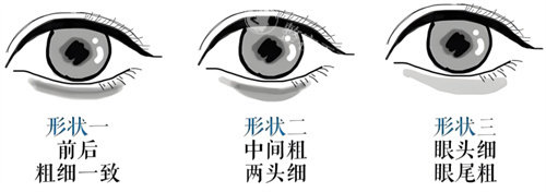 郑州贺焕焕修复卧蚕咋样​？凭借个性化方案和精细技术，收获了较好的评价