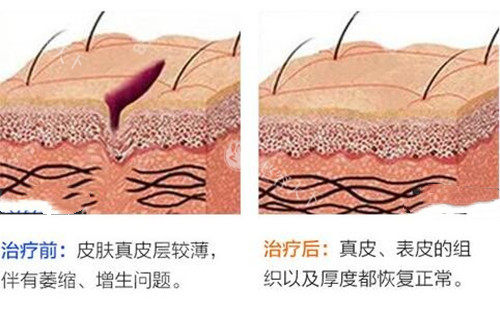 北京广济医院疤痕科的口碑，到底是夸出来的还是治出来的？正规吗？实际怎么样？患者帮你辨真假