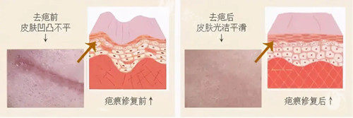 北京广济医院疤痕科的口碑，到底是夸出来的还是治出来的？正规吗？实际怎么样？患者帮你辨真假