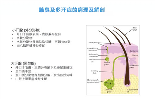 上海除腋臭手术多少钱？公布2025上海治疗腋臭手术价格表，基本在4800~13800元不等