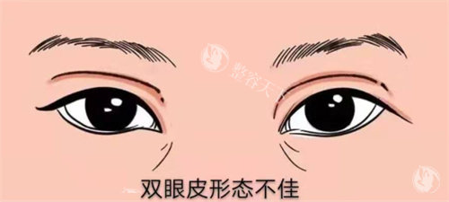 上海曾翾医生双眼皮修复怎么样​？个性化的方案设计|精细的修复技术|口碑好