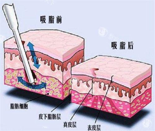 辽宁朝阳市整形医院2025价格表全公开!双眼皮|隆鼻|拉皮等价格收费透明