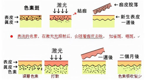 苏州超皮秒祛斑哪家医院好？这5家强推,做皮秒祛斑绝绝子