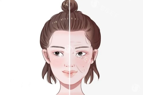 米茜尔小针自体修复靠谱吗？是一种科学、放心且有效的皮肤修复方法