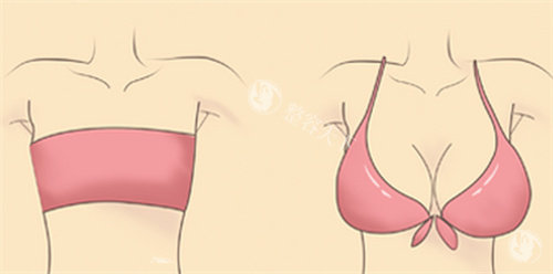 汕头爱都沪美人医疗美容怎么样?做眼鼻整形/巨乳缩小/女性私密/腋臭手术口碑好!