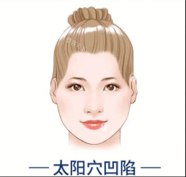 面部凹陷填充大概多少钱？2000-100000，价格范围非常大重点看填充材料及剂量