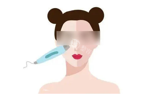 M22和黑金超光子深度对比：哪款光子嫩肤仪器更适合你的肌肤需求？