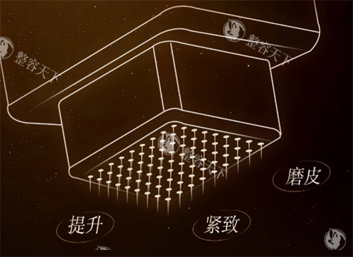 SylfirmX黄金微针在国内叫什么？认准这个名称避免被山寨仪器误导！
