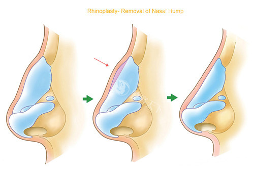 郑东学医生在韩国哪家医院坐诊？想预约他的整形手术但找不到具体信息！