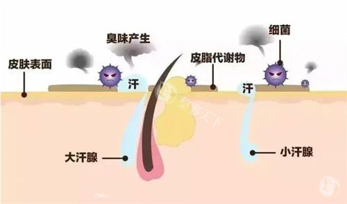狐臭困扰多年终于解决！分享在保定华美医院做清新微波治疗的真实体验！