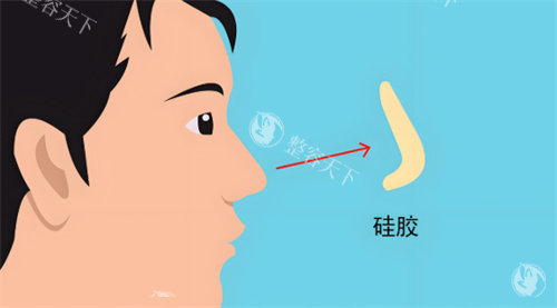 王旭东医生做鼻子怎么样​？个性化的方案设计、精细的手术技术以及良好的求美者反馈
