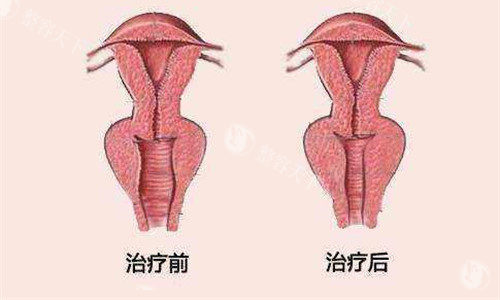 郑州哪家医院做私密紧缩针好？郑州科大/东方/中医药等医院都可以
