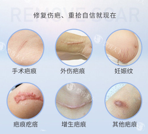 疤痕修复医师武晓莉面诊指南：问诊技巧与方案制定流程！