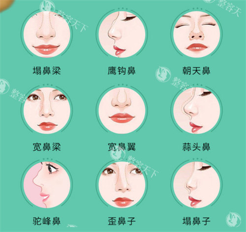 郑东学医生在韩国哪家医院坐诊？想预约他的整形手术但找不到具体信息！