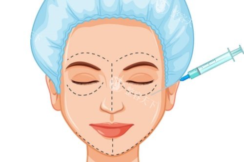 宁波哪些医院可以打玻尿酸？艺星/美莱/鄞悦纤姿/好漾/颜蕾都不错很出名的轻医美机构