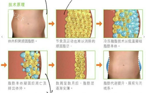 冷冻溶脂多少钱一个部位？单部位价格在2000~8000元之间