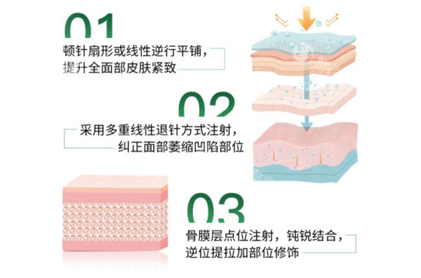 艾维岚童颜针价格会降吗?艾维岚单支价格1.28万起,降价可能性不大!