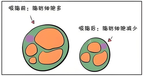 北京本爱医疗美容怎么样？看脂肪移植这篇包含实例和评价的深入分析！