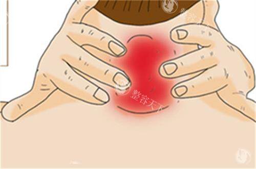 想在南宁找黄学峰医生消除富贵包？这家医院地址及详情揭秘，速来了解！